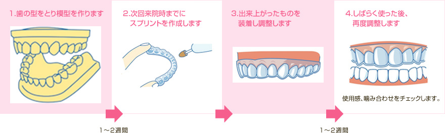 スプリントができるまで